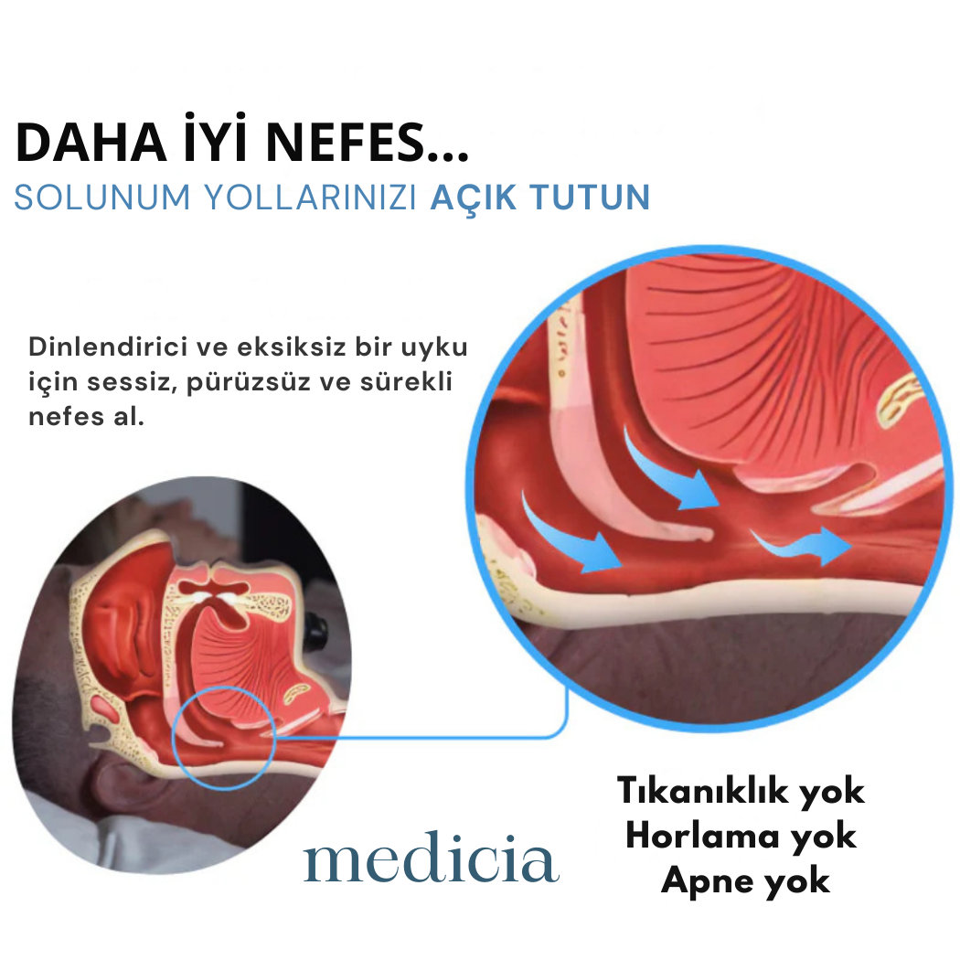 MEDİCİA™ | Horlama Önleyici Nörostimülasyon Cihazı
