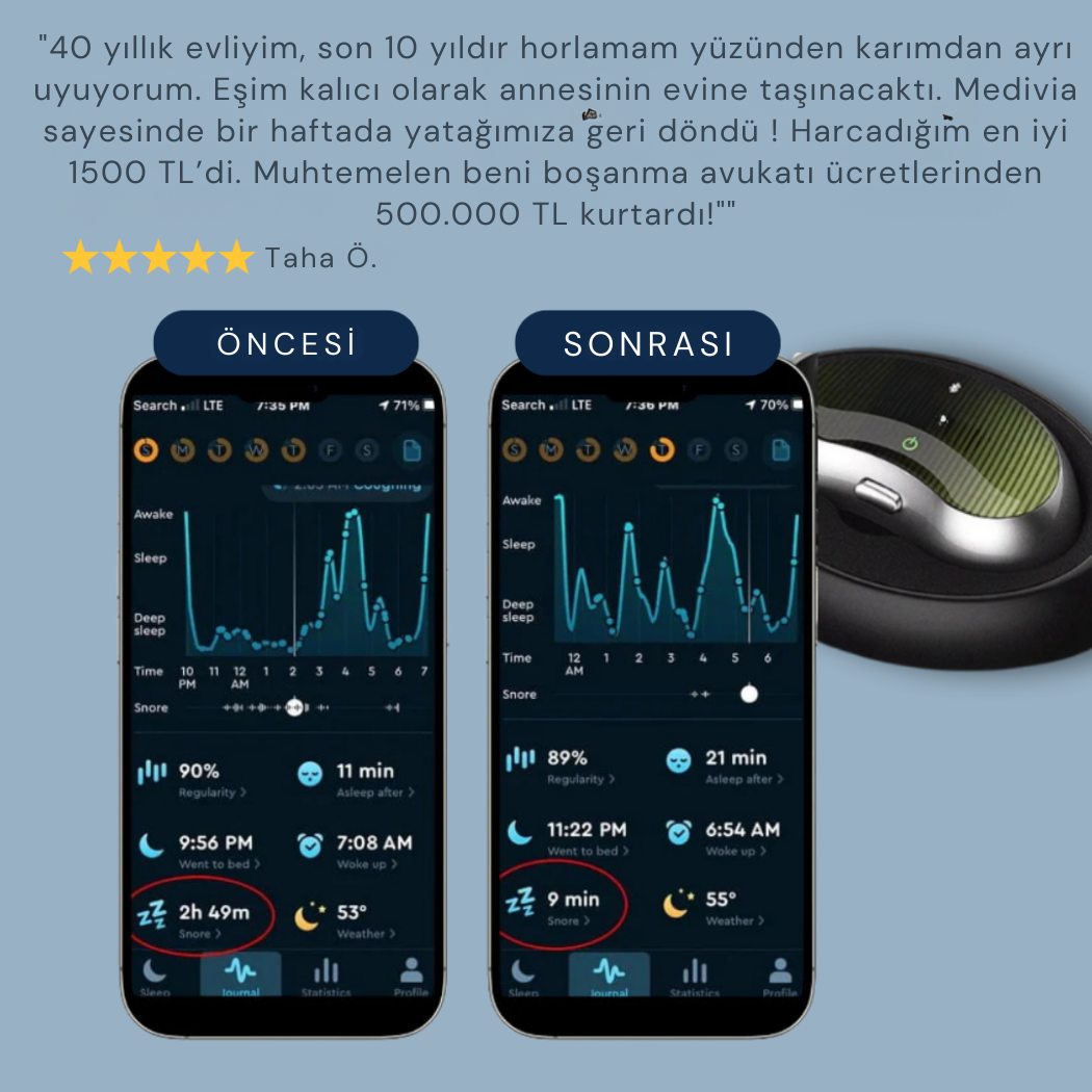 MEDİCİA™ | Horlama Önleyici Nörostimülasyon Cihazı